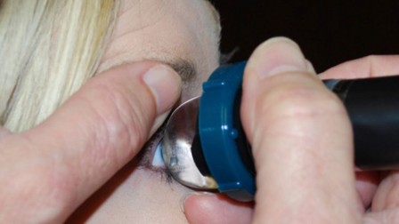 Carleton Optical - ClearScan® Probe Cover